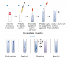 'Peritonitis Test'